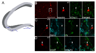 summary of Mossy cell_axon2.tif