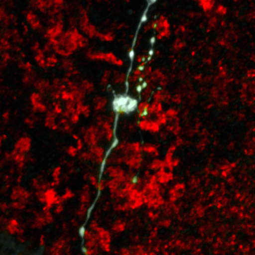 Axons compensate for biophysical constraints of variable size to uniformize their action potentials